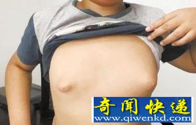 姐姐1个胸6斤重 姐弟乳房发育过大的元凶揭露